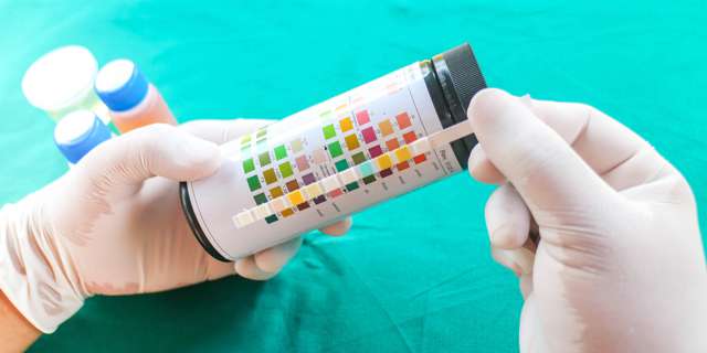 medical-test-strips-spectrophotometer.jpg